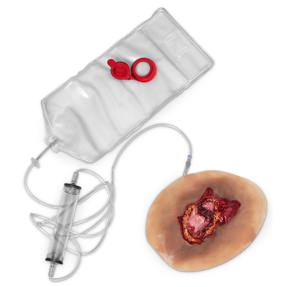 open-fracture-femur-1586-p