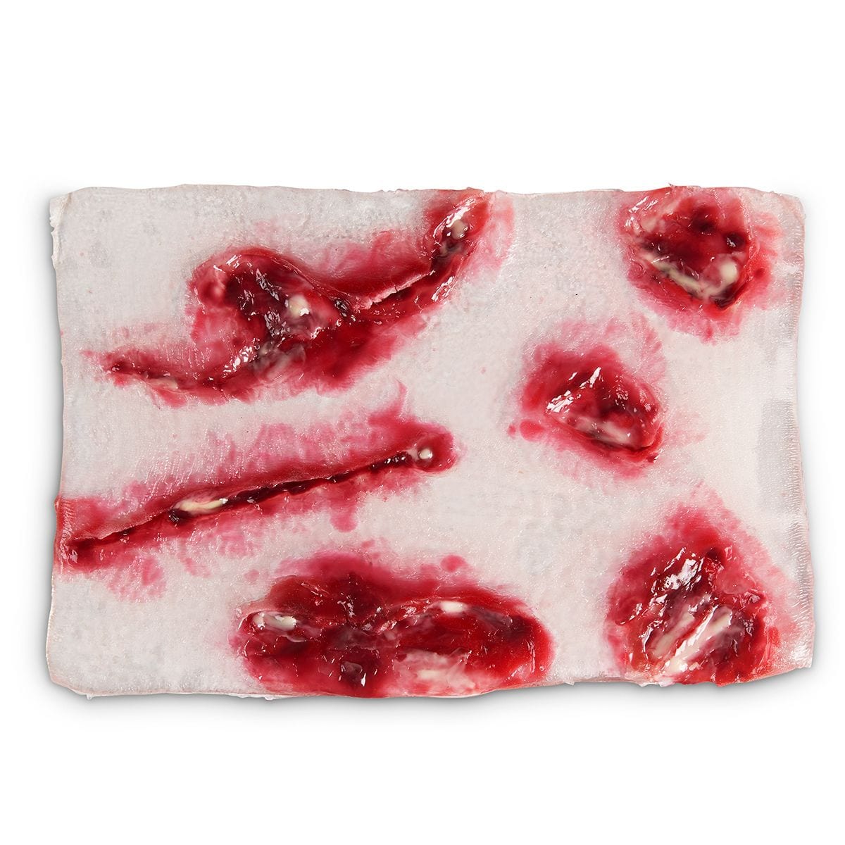 skin-tear-wound-2420-p