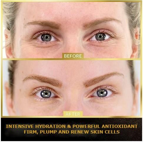 alivercosmetics60pcsUnderEye24kGoldCollagenMaskPatchesPadDarkCirclesAntiAgeingWrinklefinelinessaggingundereyebagsfinelineskincsectionscarremovaltreatmentmascara13