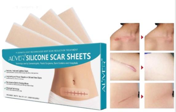siliconescarremoverremovaltreatmentpospartumscarsesarianscesarianscarcutsburnremovaltreatmentoperationsurgerycuts