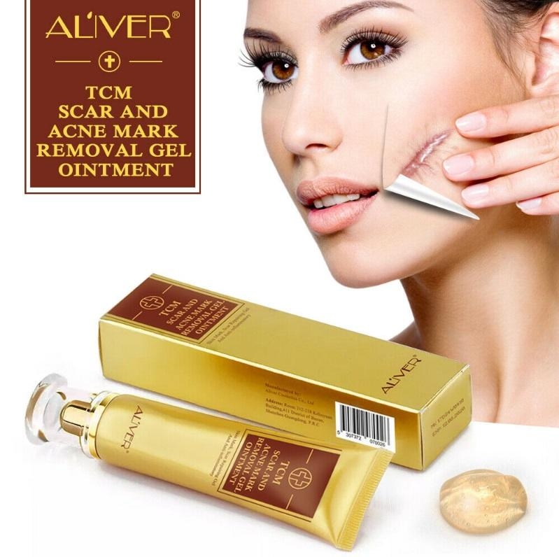 Aliver Acne Treatment & Scar Removal Cream – Aliver Cosmetics